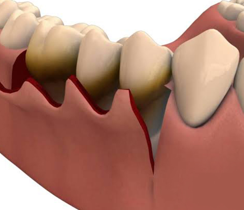 best dentist in chinchwad