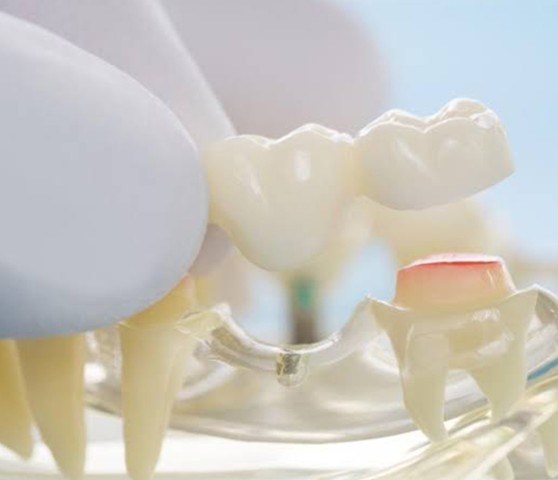 orthodontist in pune